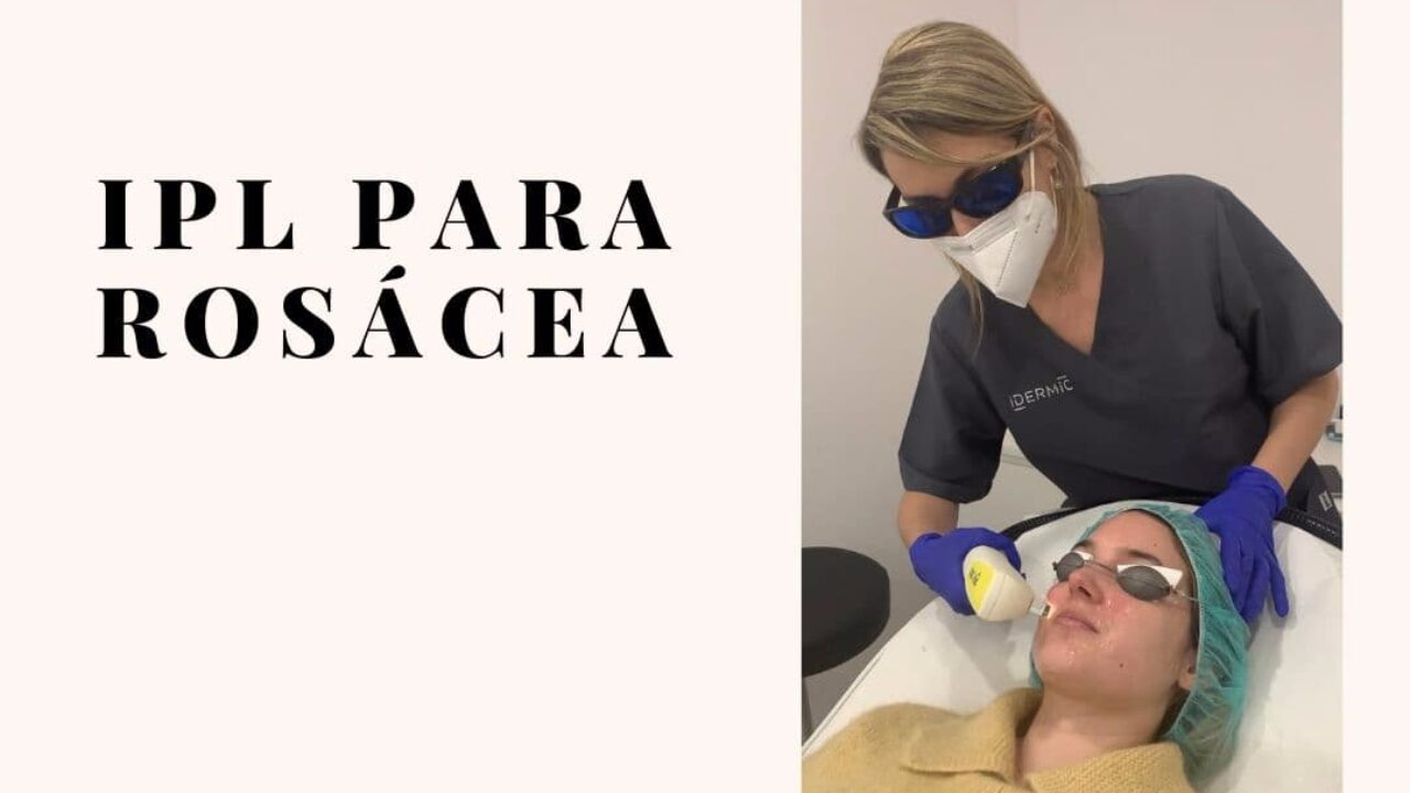 Mi experiencia con el IPL para rosacea Mi Rosacea