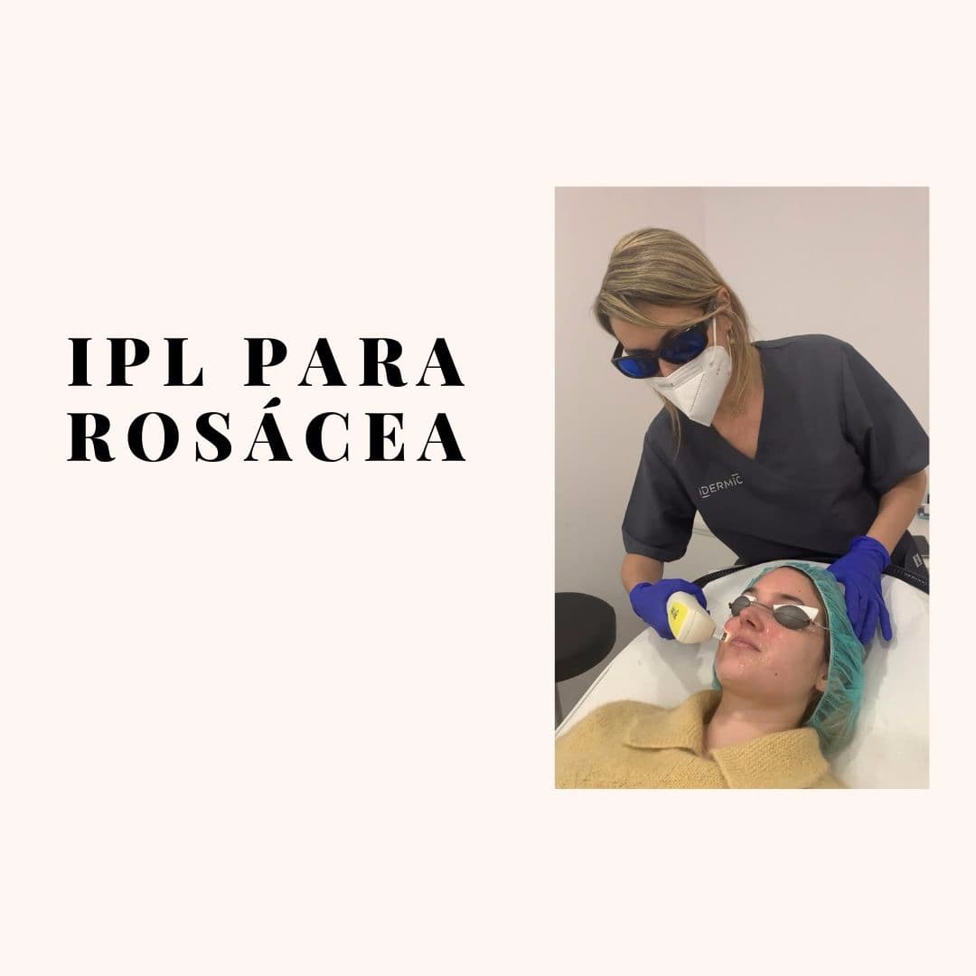 Experiencia IPL rosácea